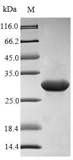 Mouse AIMP1 / EMAP II Protein (Recombinant 6His-SUMO, N-terminus)