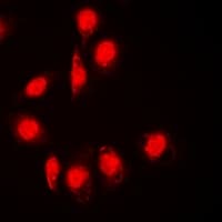 Requiem / DPF2 Antibody (Internal)