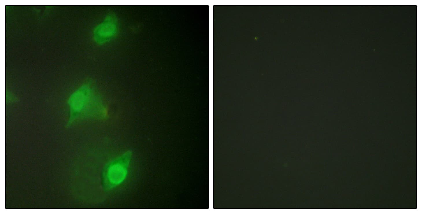AIRE Antibody (aa91-140)