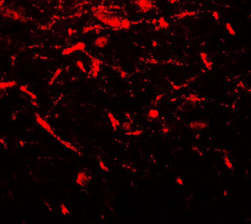 IHC-plus™ FMR1 / FMRP Antibody