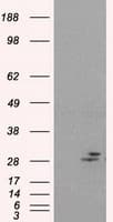 PRL / Prolactin Antibody (clone OTI2B7)