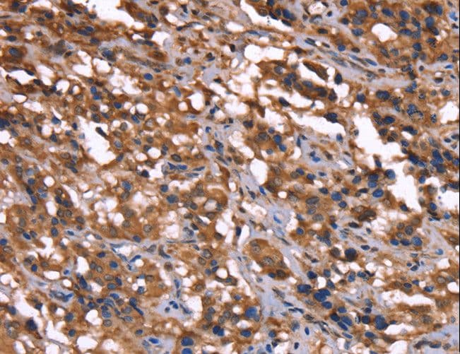 Polyclonal Rabbit anti-Human GREB1 Antibody (IHC)