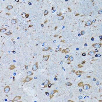 Polyclonal Rabbit anti-Human RARS Antibody (IHC, IF, WB)
