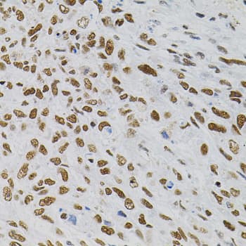 Polyclonal Rabbit anti-Human AKAP8 / AKAP95 Antibody (AP, IHC, WB)