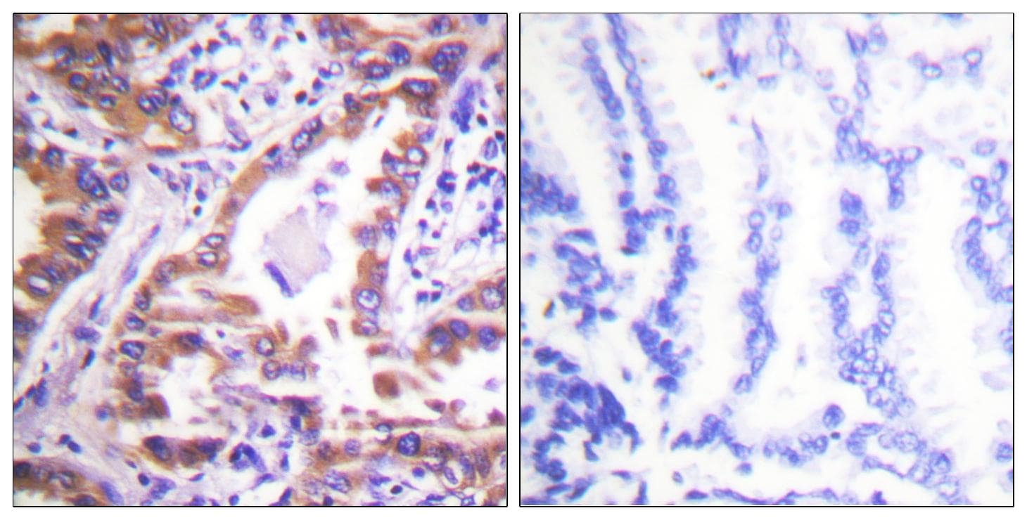 Polyclonal Rabbit anti-Human CANX / Calnexin Antibody (p583, IHC, IF, WB)