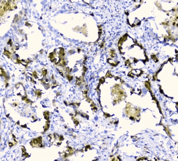 Polyclonal Rabbit anti-Human CDA / Cytidine Deaminase Antibody (IHC, WB)