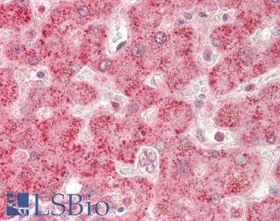 IHC-plus™ CYP27 / CYP27A1 Antibody (aa101-150)
