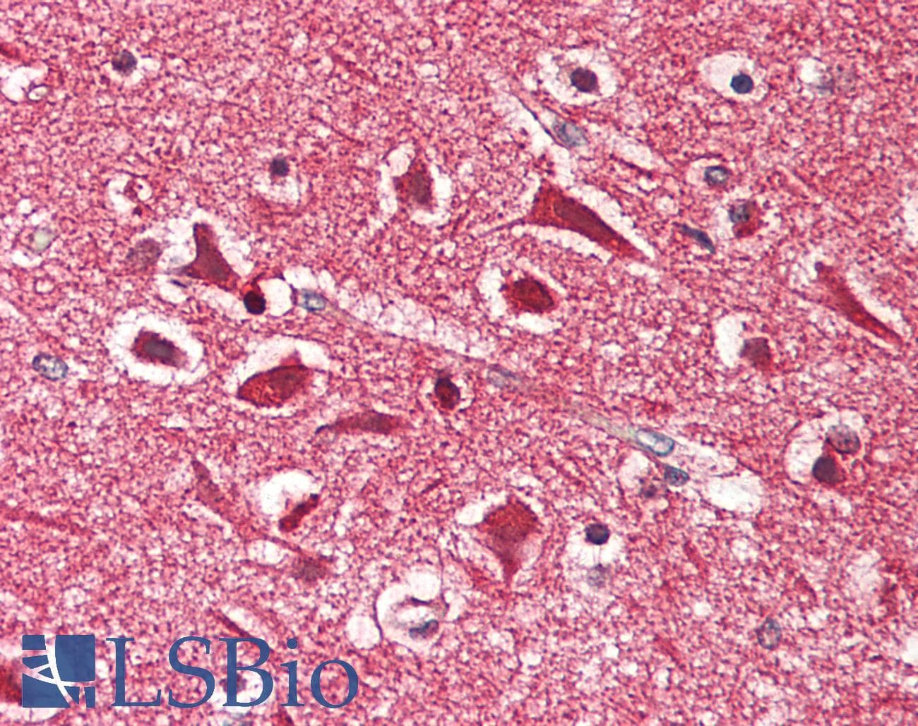 IHC-plus™ MAPRE2 / EB2 Antibody (aa300-350)