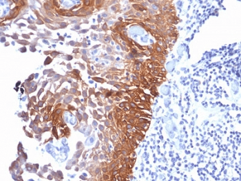 KRT17 / CK17 / Cytokeratin 17 Antibody (clone E3, Azide-free, BSA-free)
