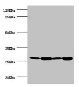 Polyclonal Rabbit anti-Human BAP29 / BCAP29 Antibody (IHC, WB)