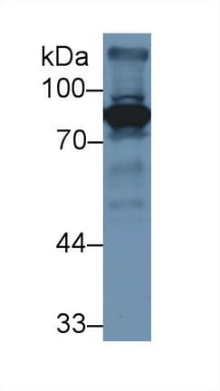 F2 / Prothrombin / Thrombin Antibody (aa201-324)