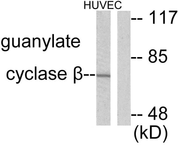 IHC-plus™ GUCY1B3 Antibody (aa10-59)
