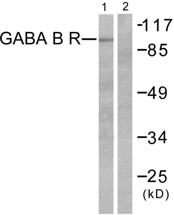GABBR1 / GABA B Receptor 1 Antibody