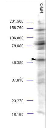 IHC-plus™ Polyclonal Rabbit anti-Human NEK2 Antibody (IHC, IF, WB)