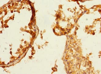PVRL3 / Nectin-3 Antibody