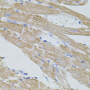 TRPA1 Antibody
