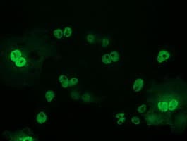 TP53 / p53 Antibody (clone OTI5B2)