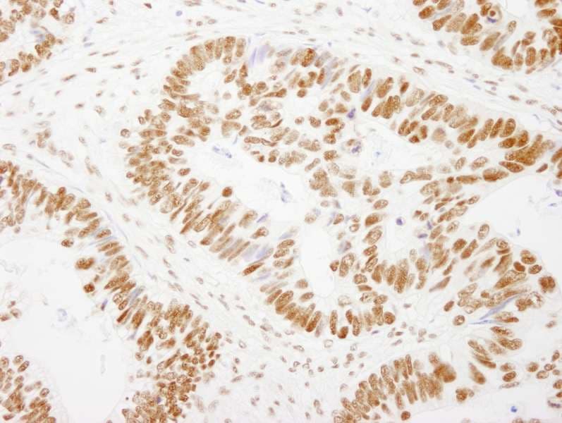 Polyclonal Rabbit anti-Human GTF2I / TFII I Antibody (aa985-998, IHC, IF)