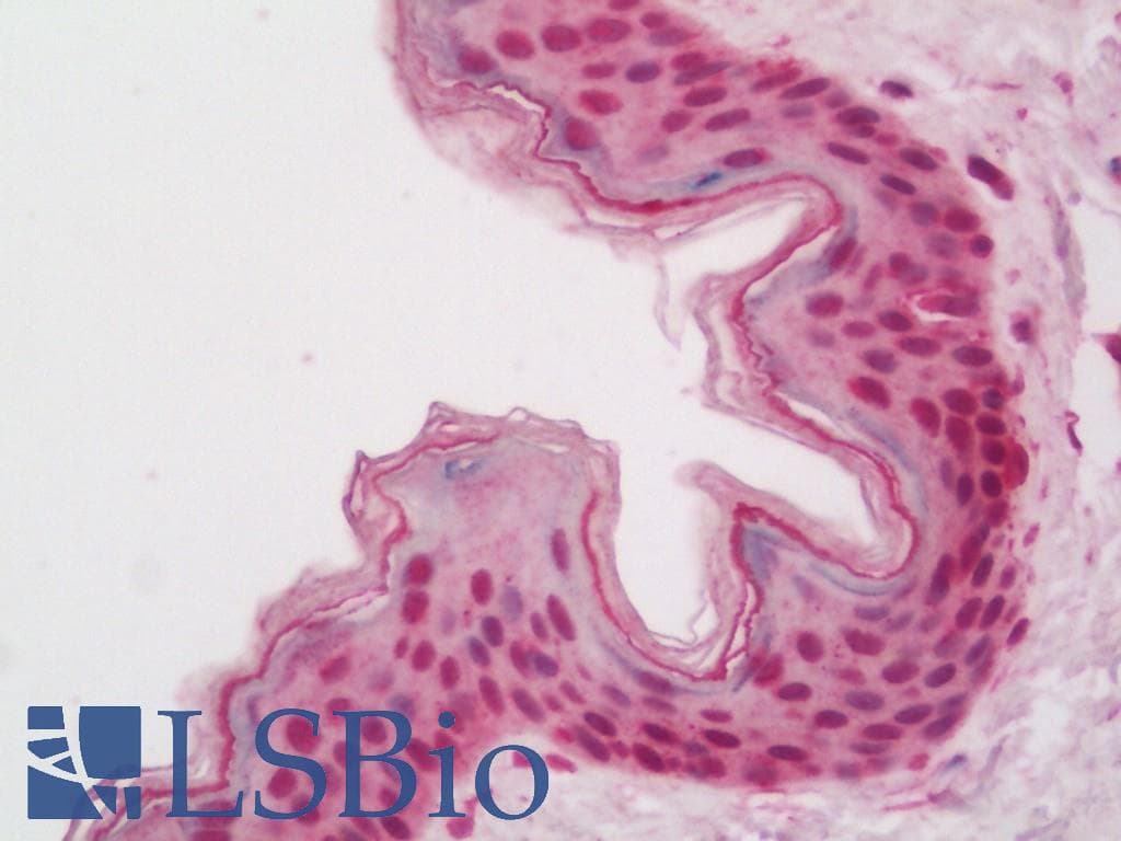 IHC-plus™ SOX4 Antibody
