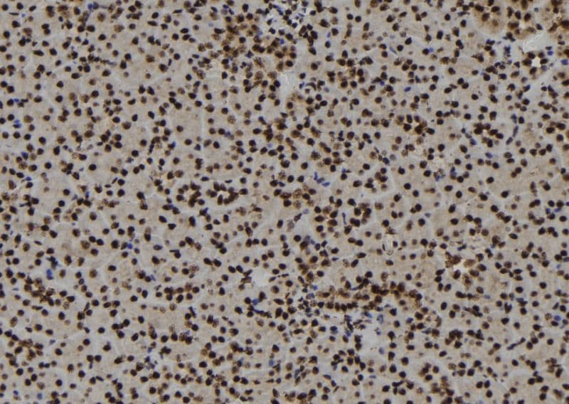 Polyclonal Rabbit anti-Human E2F3 Antibody (IHC, WB)