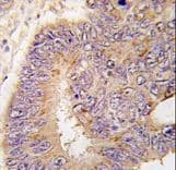 Polyclonal Rabbit anti-Human PDE8A Antibody (aa557-587, IHC, WB)