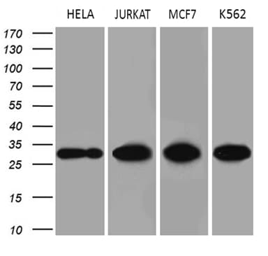 PCMT1 Antibody (aa60-285, clone OTI2A9)