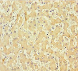 COL6A6 Antibody (aa430-982)
