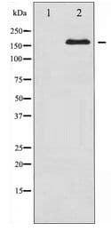 Polyclonal Rabbit anti-Human IRS1 Antibody (IHC, IF, WB)