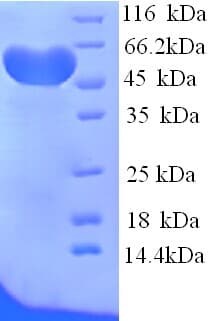 Rat HPX / Hemopexin Protein (Recombinant His)