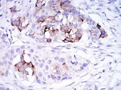 Monoclonal Mouse anti-Human SCGB2A2 / Mammaglobin A Antibody (clone 3C8, IHC, IF, WB)