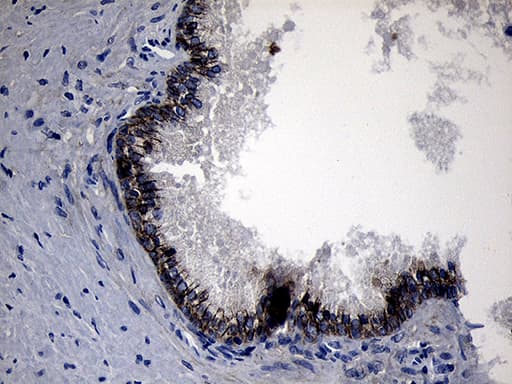 Monoclonal Mouse anti-Human ROR2 Antibody (clone OTI4B10, aa796-927, IHC, WB)