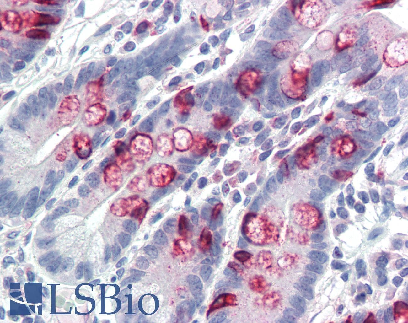 IHC-plus™ Mucin 2 / MUC2 Antibody (clone SPM512)