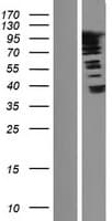 Human SUPT20HL2 / FAM48B2 Protein (Over-Expression Lysate Myc-DDK (Flag))