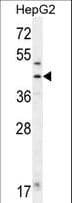 Polyclonal Rabbit anti-Human FAH Antibody (aa7-33, IHC, IF, WB)