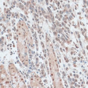 Polyclonal Rabbit anti-Human ZNF562 Antibody (IHC)
