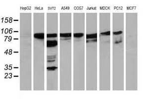 BCAR1 / p130Cas Antibody (clone OTI3A5)
