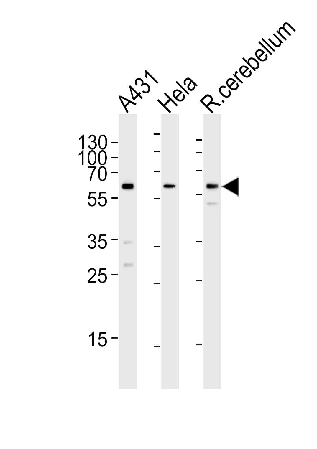 Polyclonal Rabbit anti-Human KISS1R / GPR54 Antibody (aa235-263, WB)
