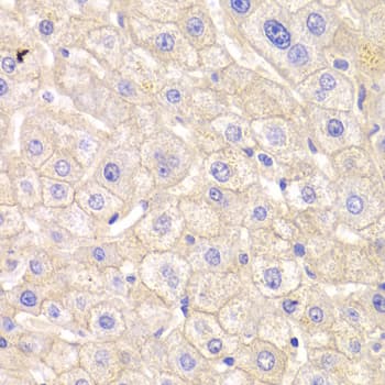 CTNND1 / p120 Catenin Antibody