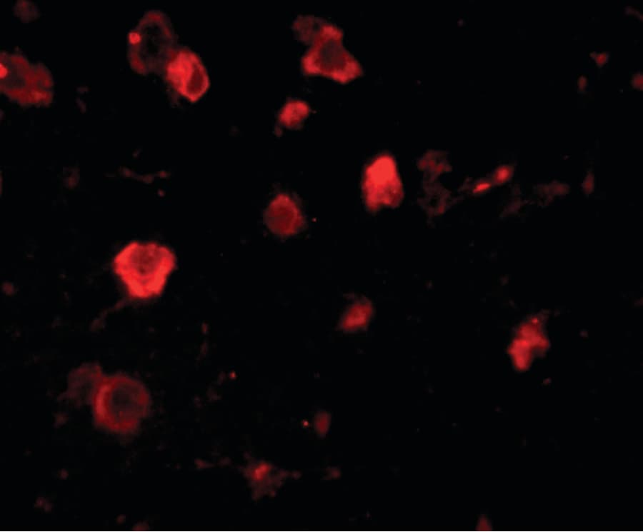 Polyclonal Rabbit anti-Human SLITRK4 Antibody (IHC, IF, WB)