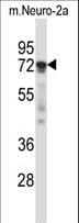 PRKCZ / PKC-Zeta Antibody (aa1-30)