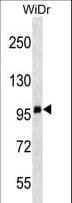 Monoclonal Mouse anti-Human CD68 Antibody (aa133-160, WB)