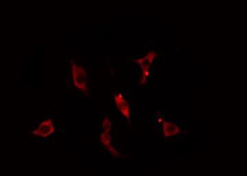 RNF125 / TRAC-1 Antibody