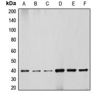 Polyclonal Rabbit anti-Human DNAJB1 / Hsp40 Antibody (C-Terminus, IHC, IF, WB)