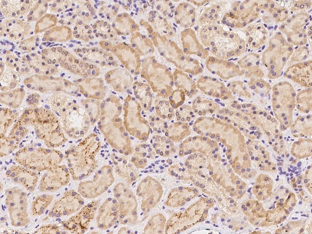 GCAT Antibody