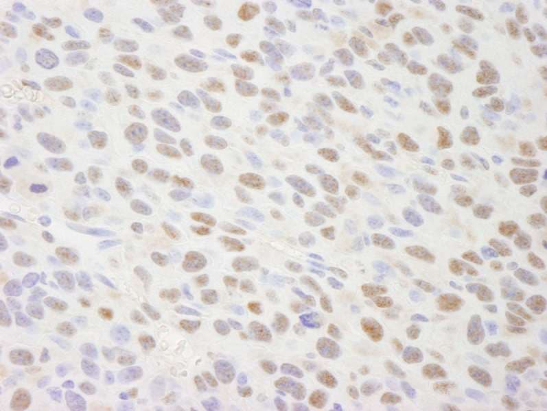 TRIM24 / TIF1 Antibody (aa700-750)