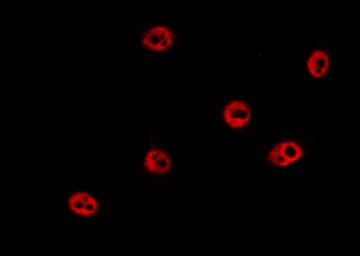 HIST1H1E Antibody (phospho-Thr17)