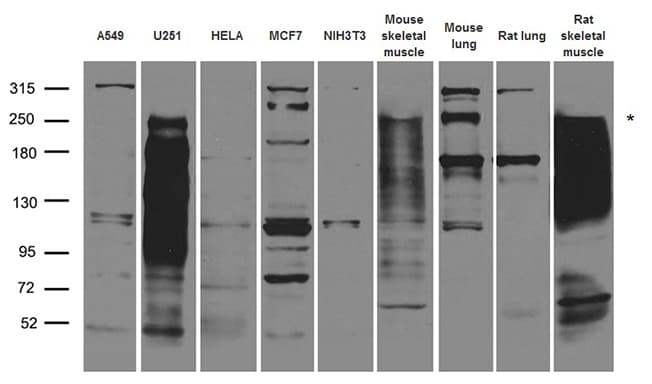 ITGB4 / Integrin Beta 4 Antibody