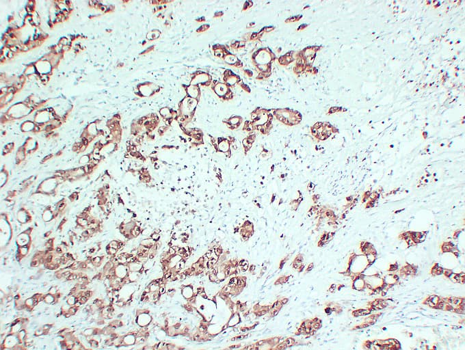 S100P Antibody (clone ABT-S100P)
