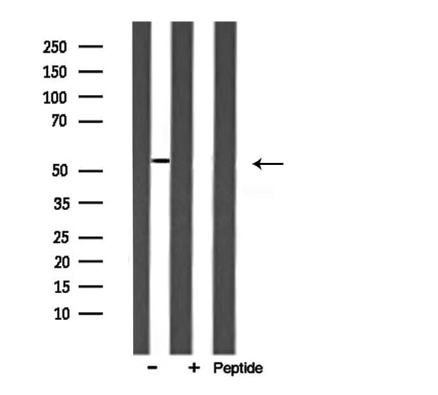 ARMC6 Antibody