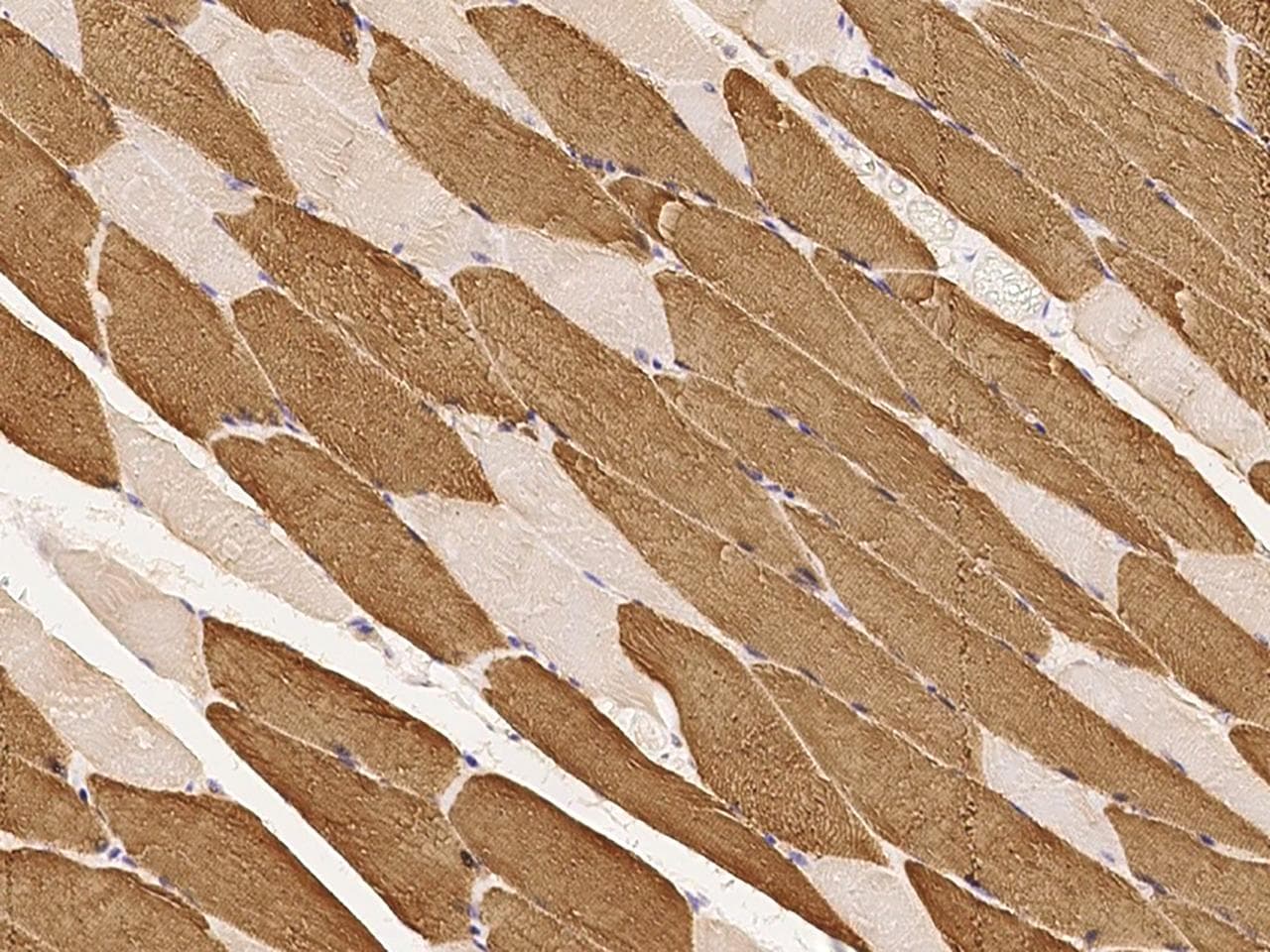 TNNC1 / Cardiac Troponin C Antibody (Preservative Free)